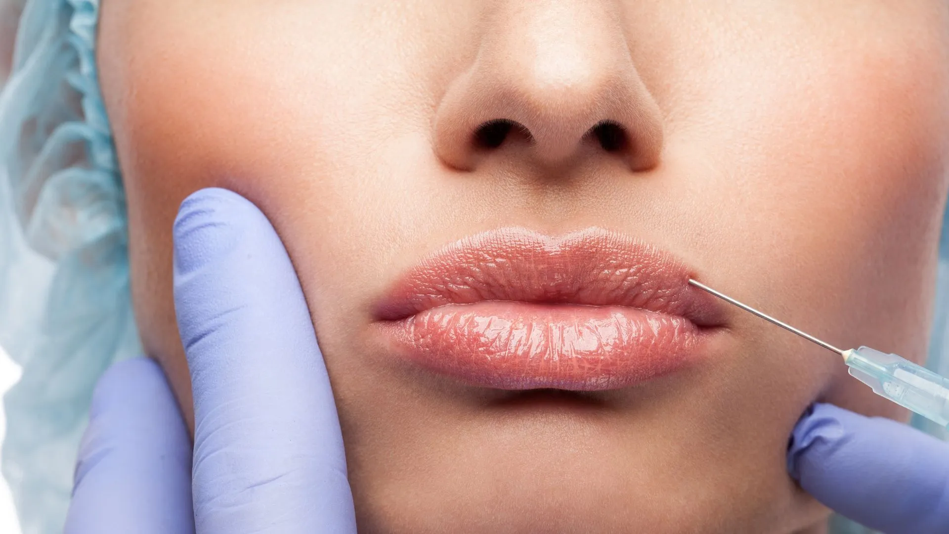 Choosing a qualified Botox provider in Towson
