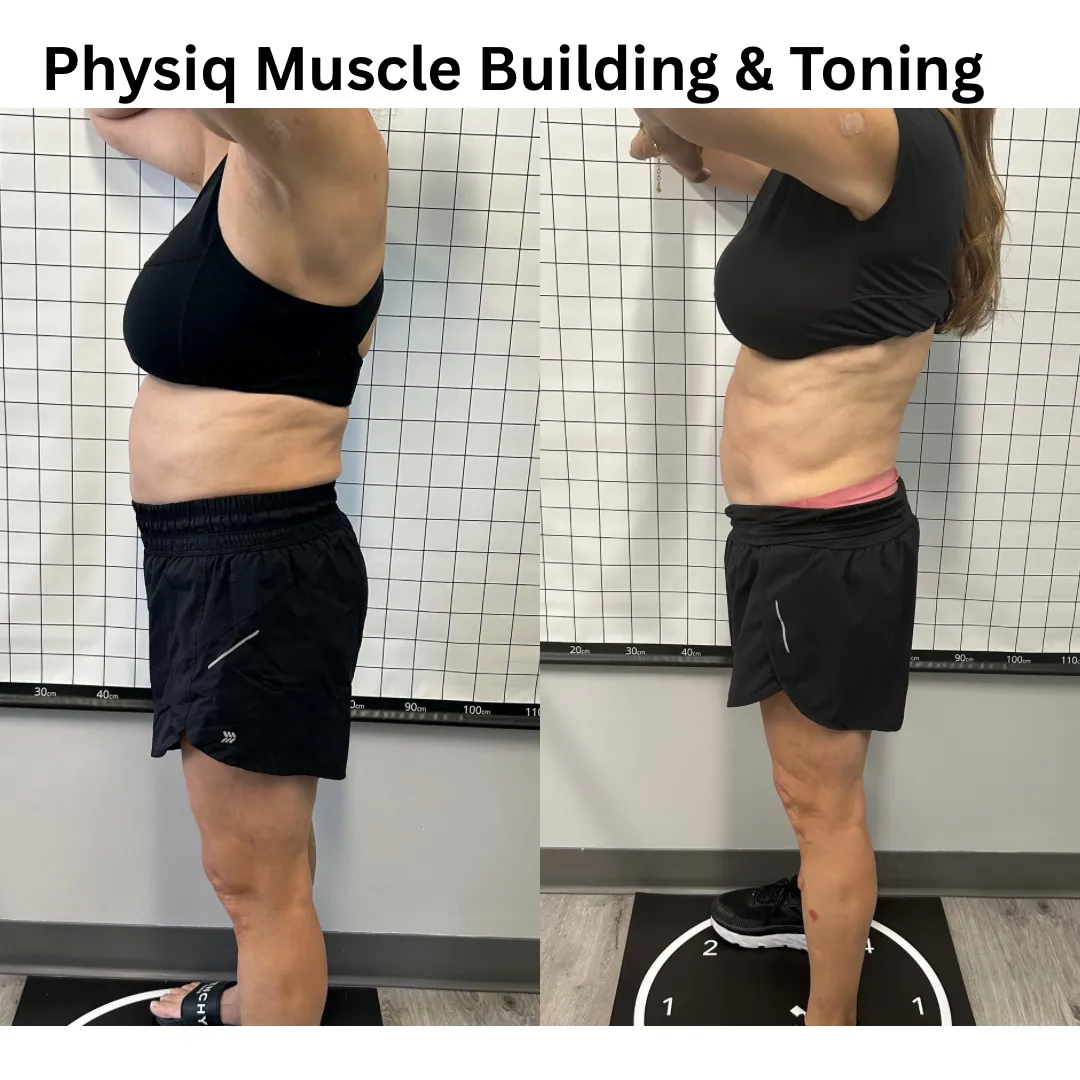 Body contouring transformation in Timonium, Maryland