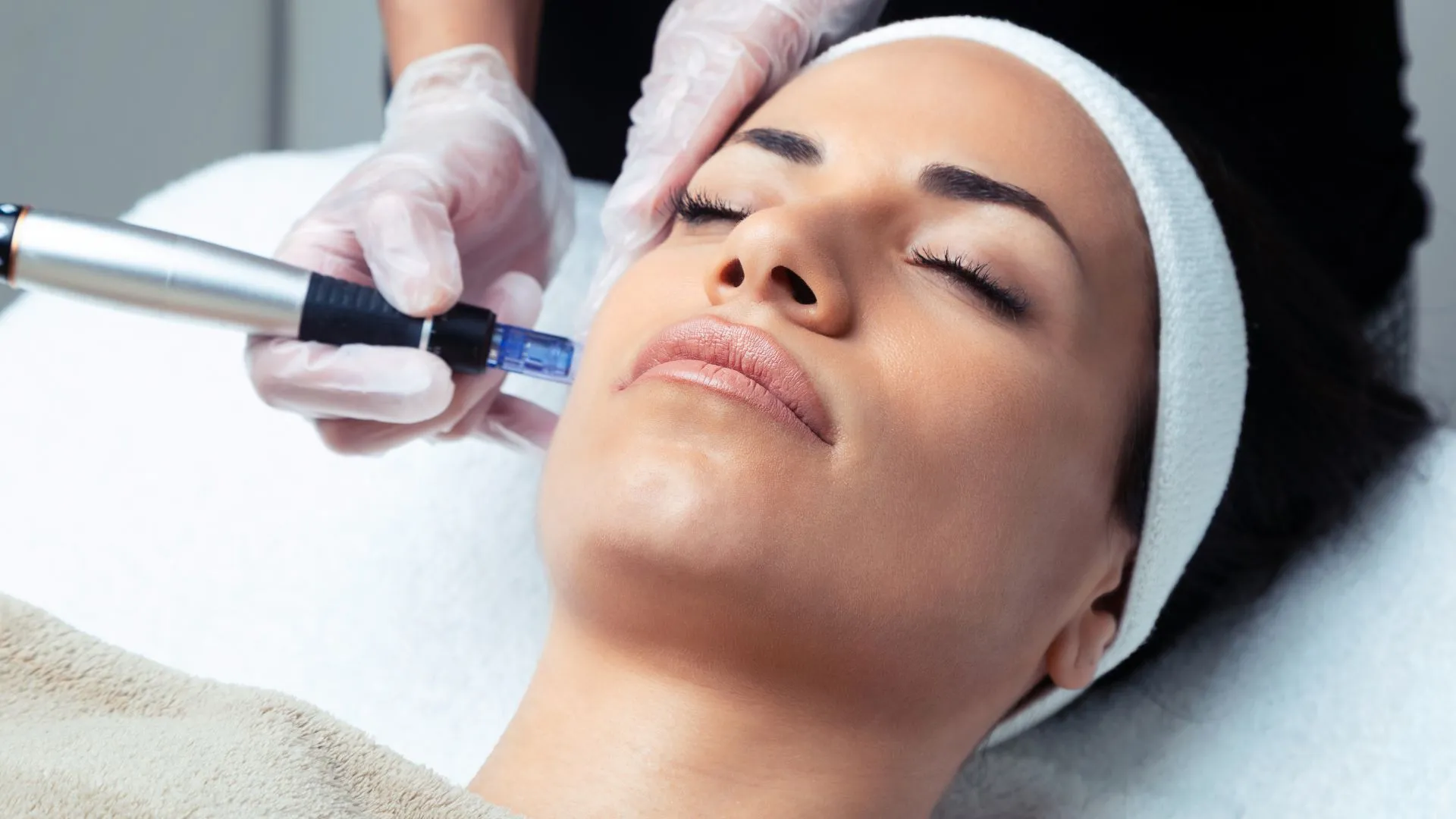 Client receiving a microneedling facial treatment to support preventative skincare and early collagen preservation in Timonium, Maryland.
