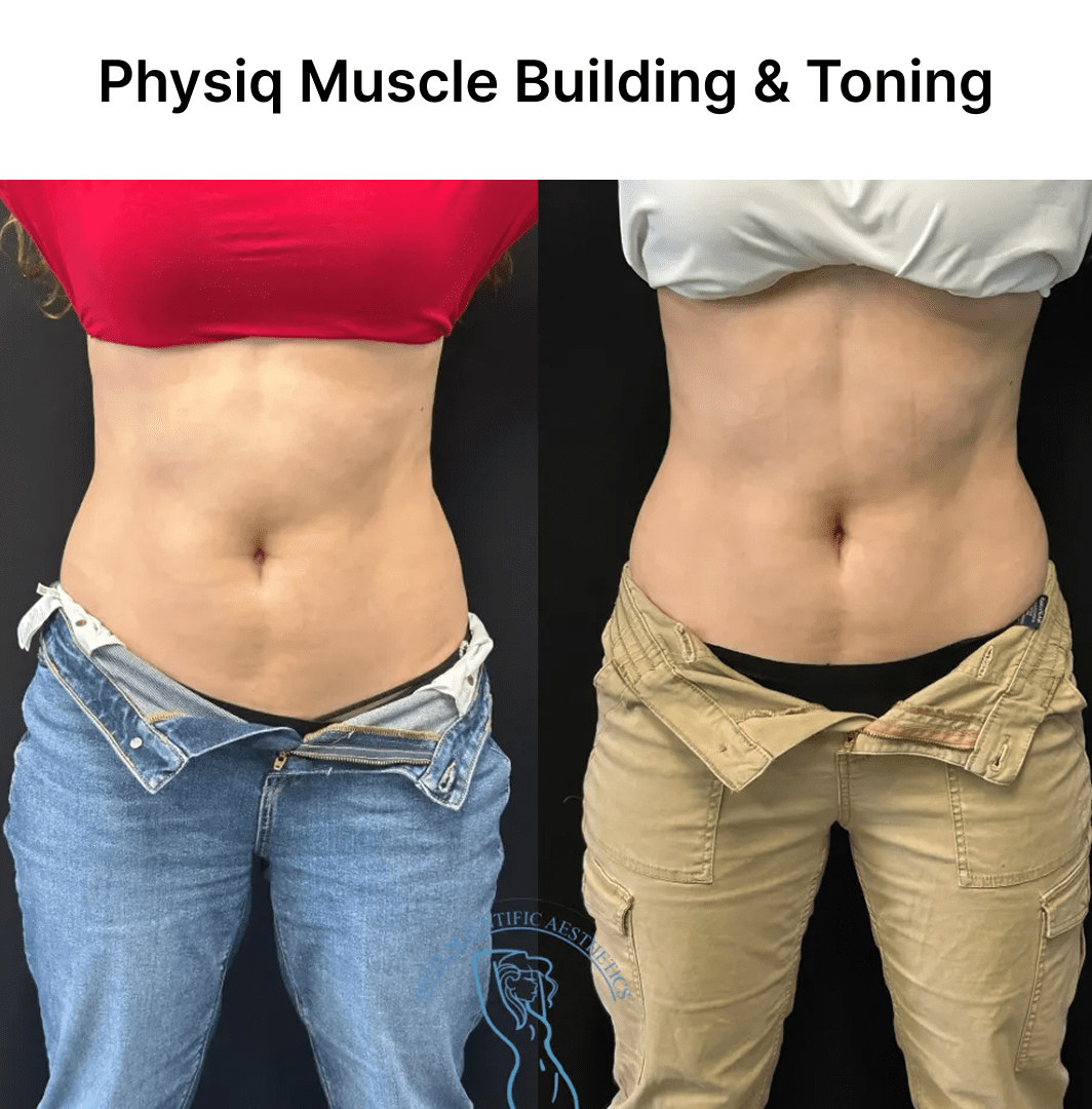 Before and after muscle toning transformation of a woman's midsection.