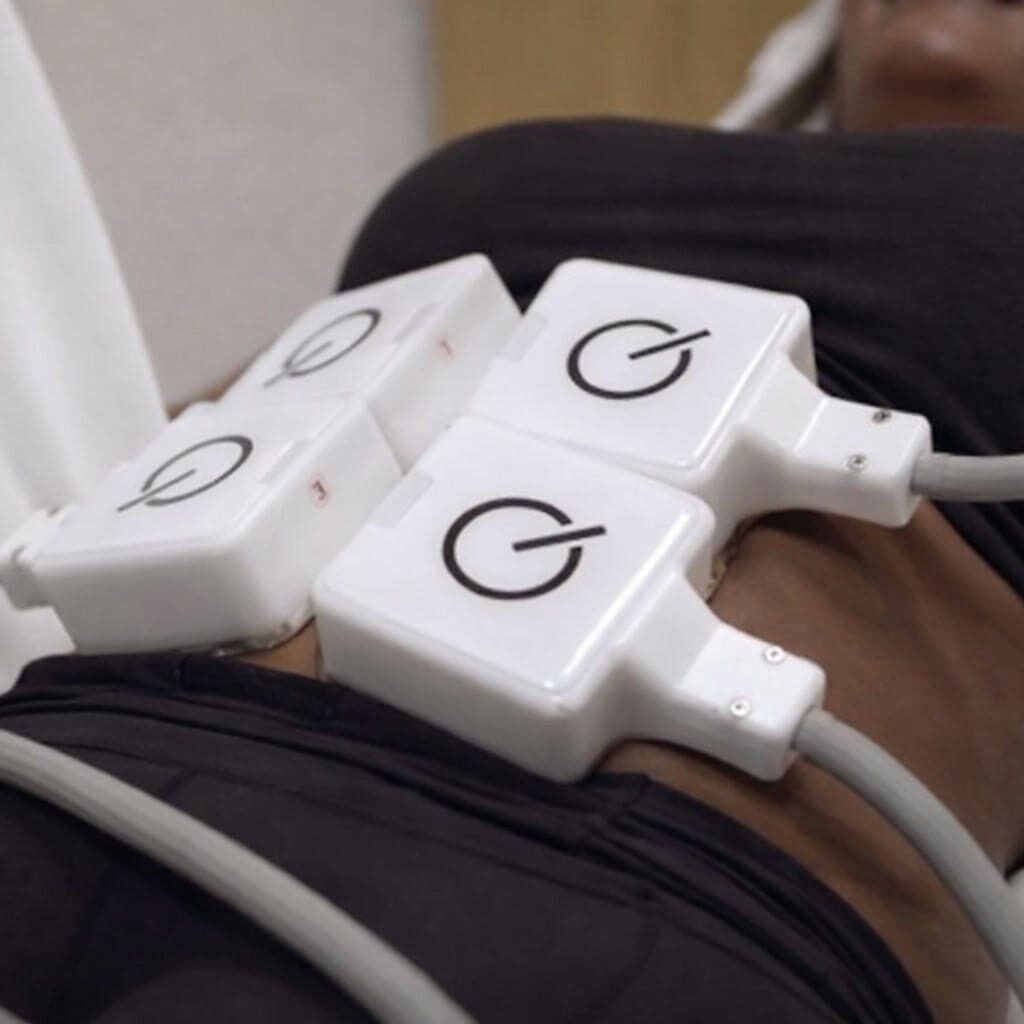 Close-up of white electronic devices connected to a person’s abdomen.