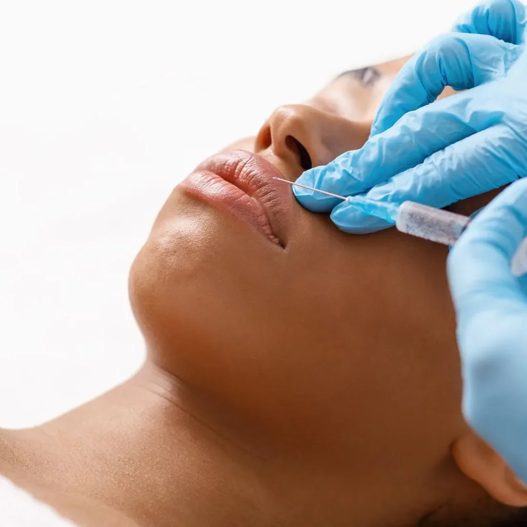Affordable Botox treatment for fine lines in Towson
