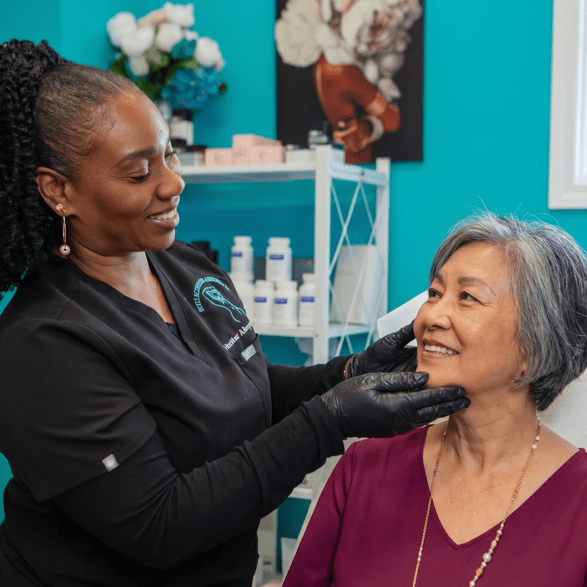 Chemical Peel after photo