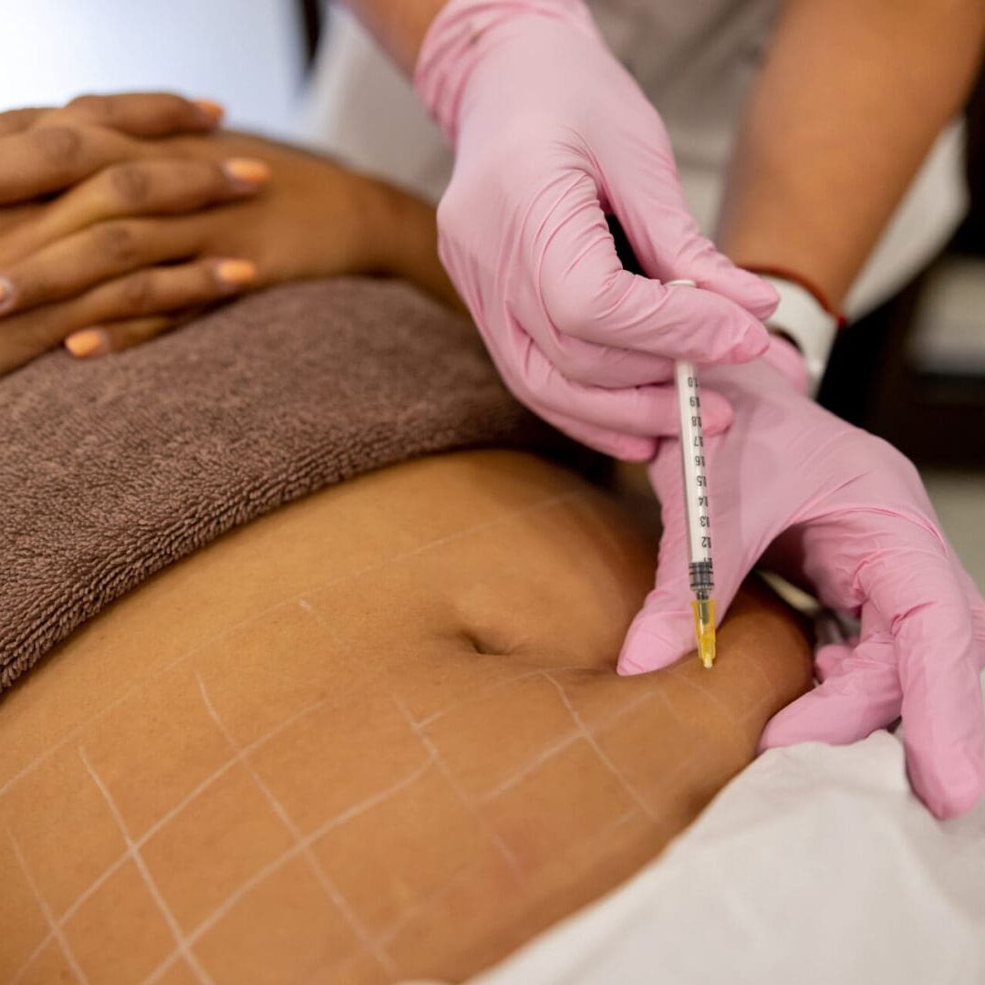 A professional injecting a substance into a marked abdomen area.