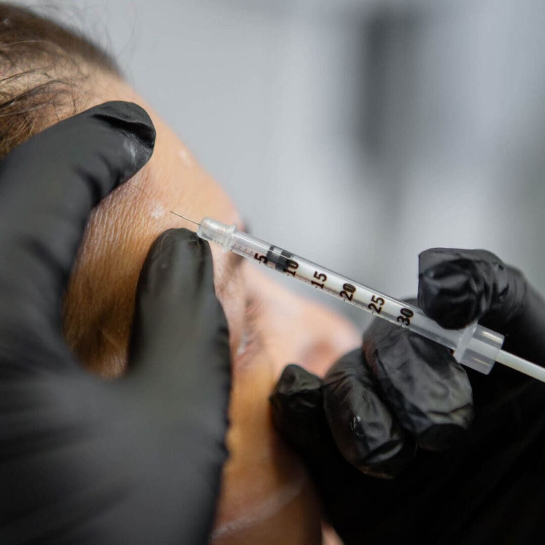 A person receiving a cosmetic injection in the forehead.