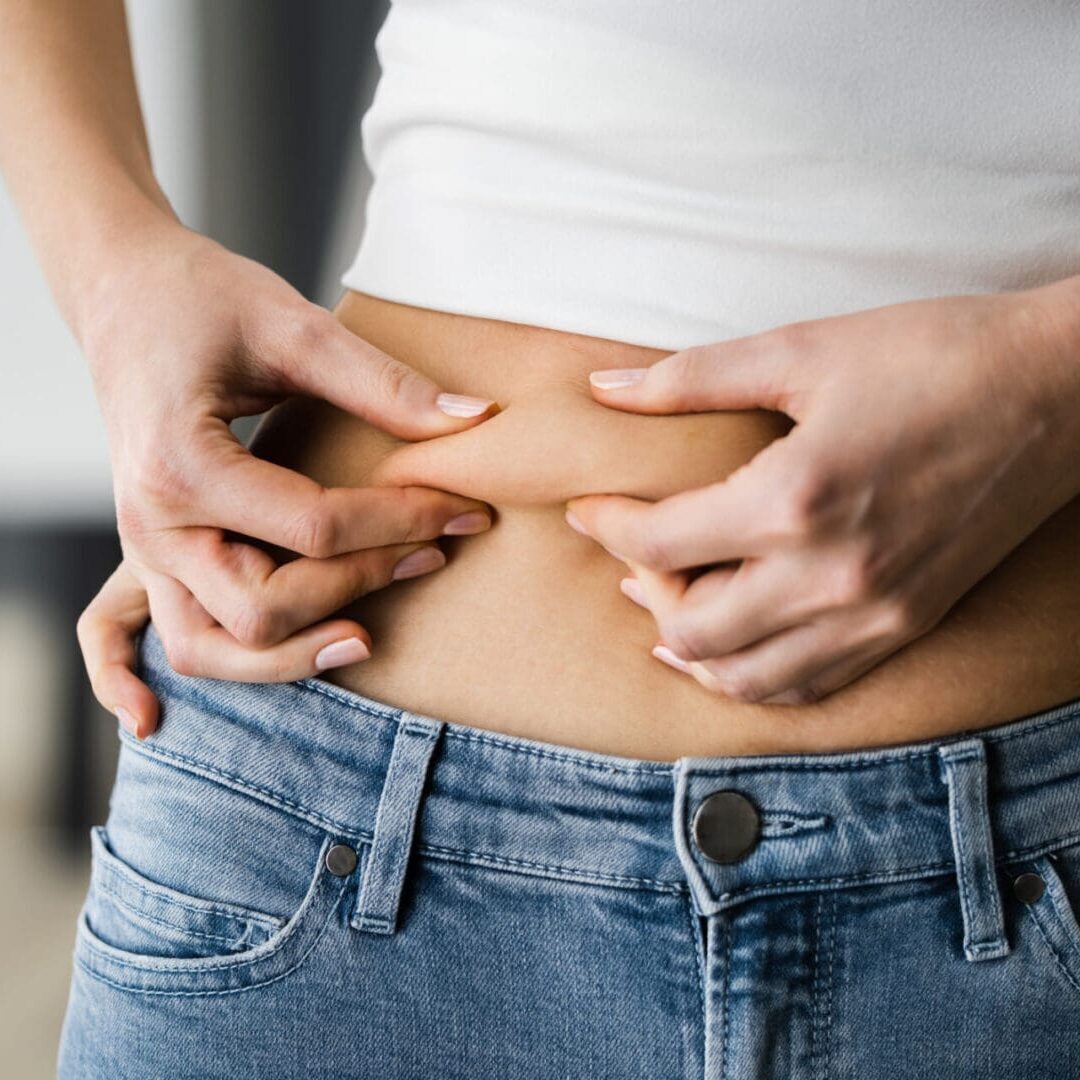 Close-up of a client pinching stomach skin, highlighting stubborn fat target areas for body contouring near Ruxton.